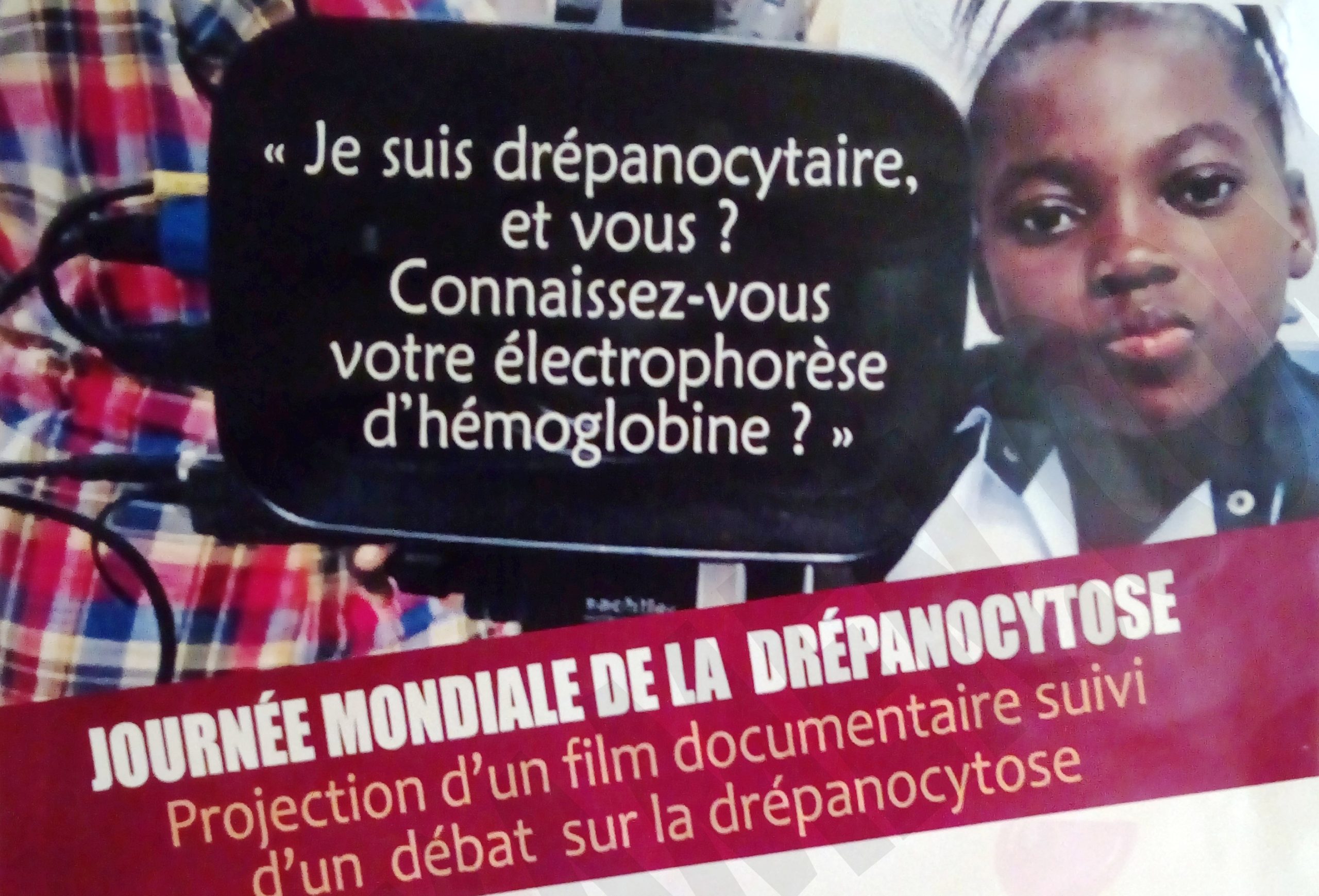 Film documentaire sur la drépanocytose en projection à Yaoundé