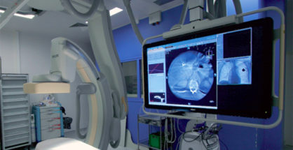Plateau Technique Hopital